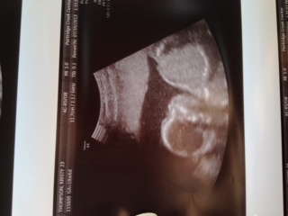 Name:  baby2.JPG
Views: 90
Size:  27.1 KB