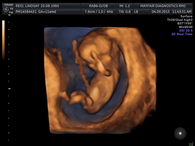 Name:  BABY_6.jpg
Views: 331
Size:  80.6 KB