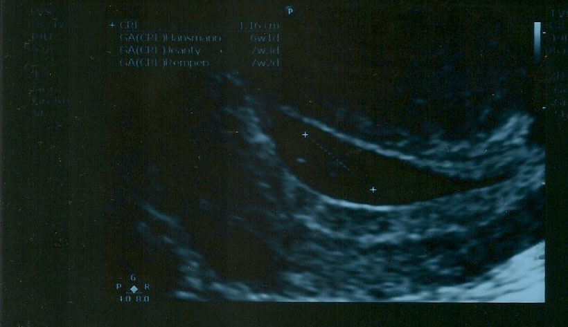 Name:  scan10001_e.jpg
Views: 1711
Size:  84.6 KB
