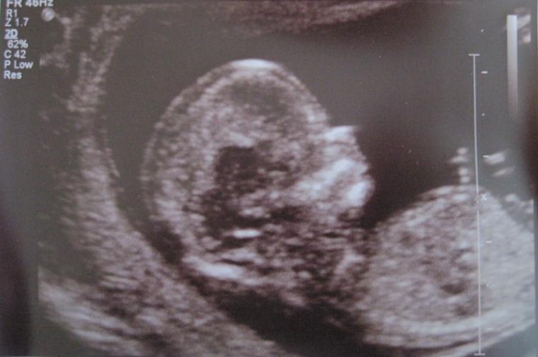 Name:  scan2.JPG
Views: 112
Size:  37.5 KB