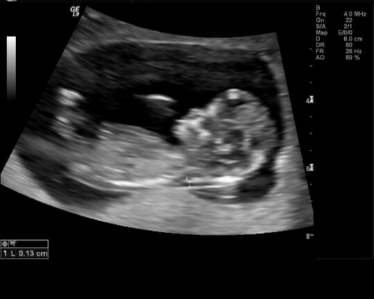 Name:  BabyC.JPG
Views: 119
Size:  64.9 KB