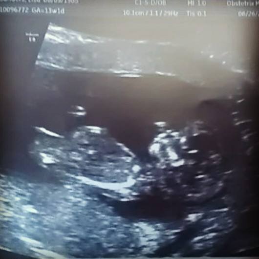 Name:  babynub.jpg
Views: 227
Size:  25.3 KB