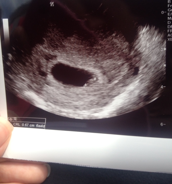 Name:  baby#2.JPG
Views: 715
Size:  110.5 KB