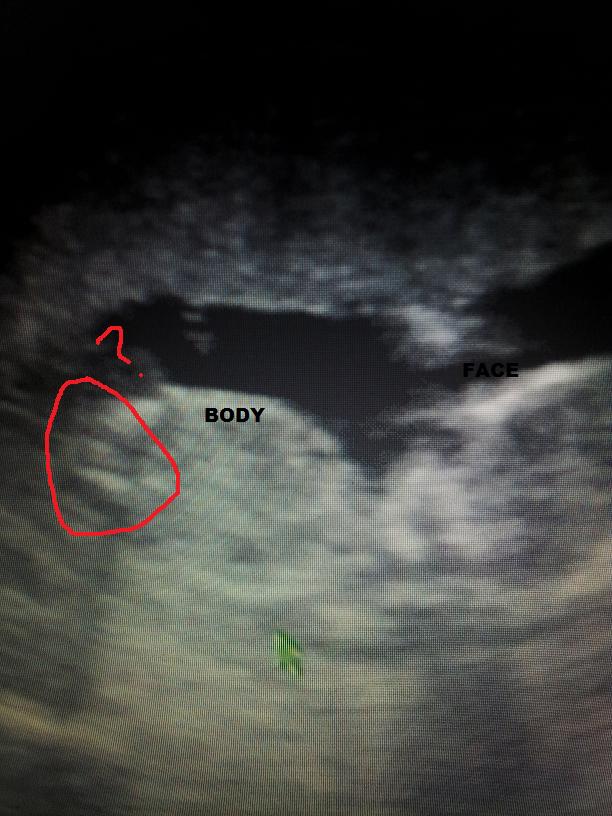 Name:  new ultrasound 31.jpg
Views: 157
Size:  83.8 KB