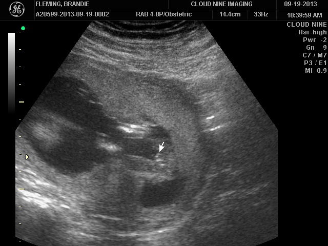Name:  IMAGES_8.JPG
Views: 180
Size:  120.5 KB