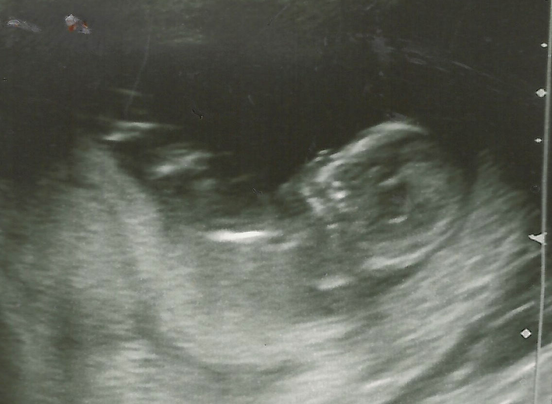 Name:  BABY 20002.jpg
Views: 560
Size:  127.7 KB