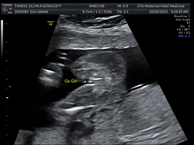 Name:  TONEYS_ELLYN_8.jpg
Views: 240
Size:  107.1 KB