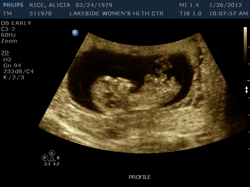 Name:  Alicia 004.JPG
Views: 4383
Size:  202.5 KB