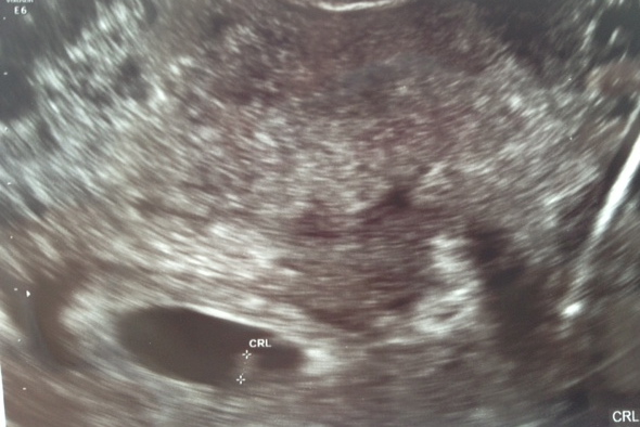 Name:  baby stewart #3.jpg
Views: 155
Size:  99.5 KB
