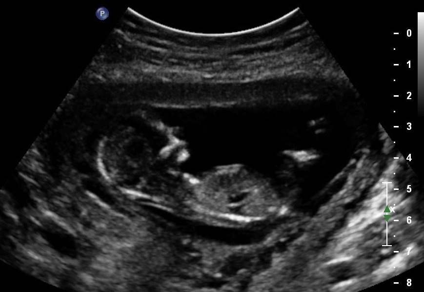 Name:  baby3.jpg
Views: 113
Size:  101.8 KB