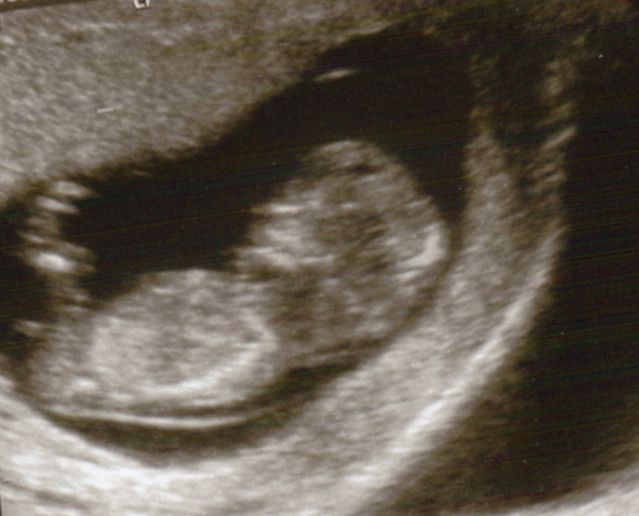 Name:  Baby Oldfield Number 3 Small.jpg
Views: 135
Size:  43.0 KB