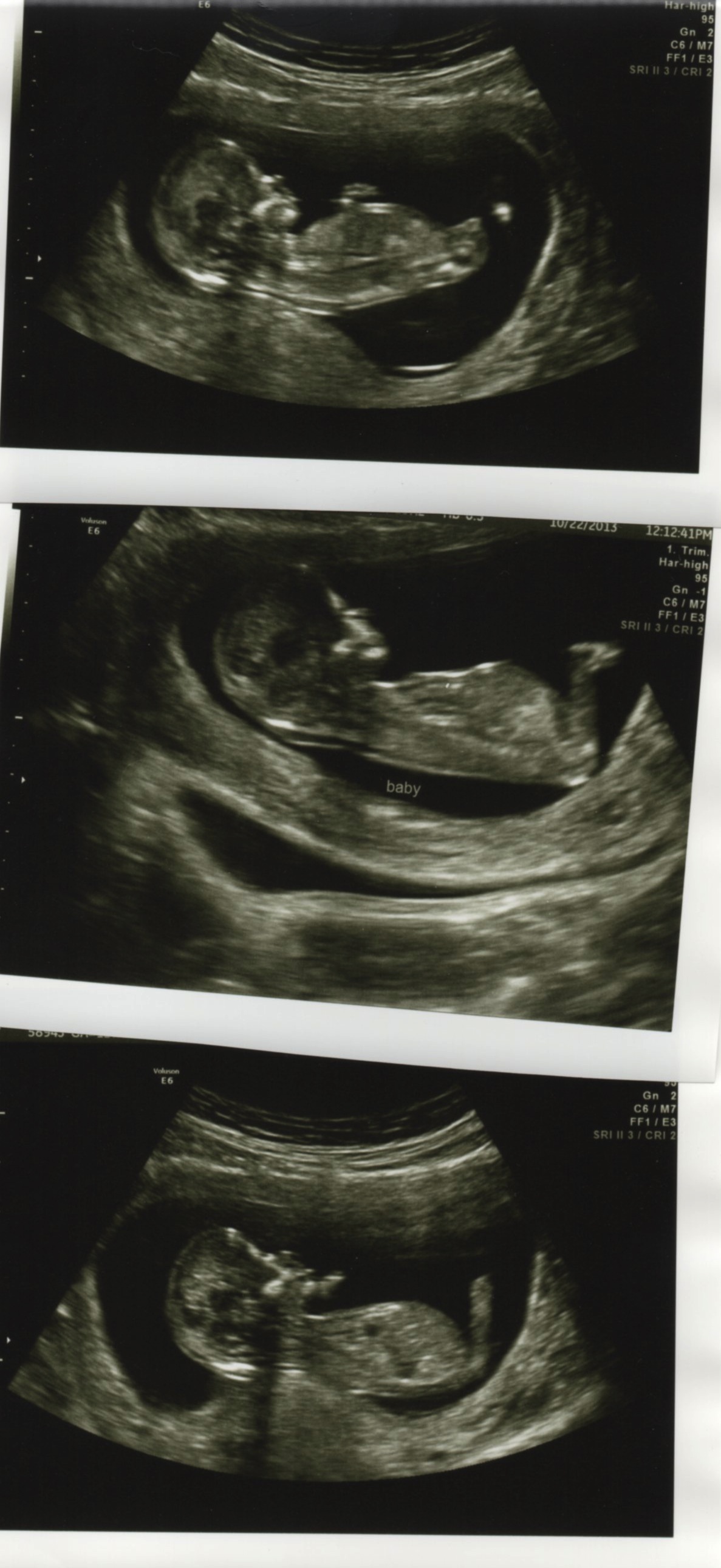 Name:  profile ultrasounds.jpg
Views: 281
Size:  403.6 KB