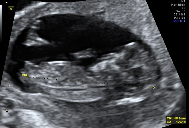 Name:  12+1 scan 1.jpg
Views: 202
Size:  105.3 KB