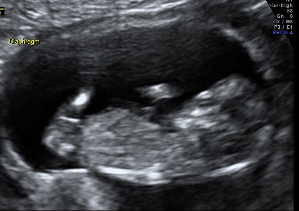 Name:  12+1 scan 2.jpg
Views: 203
Size:  92.7 KB