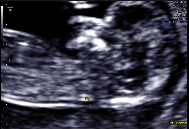 Name:  12+1 scan head.jpg
Views: 184
Size:  100.7 KB