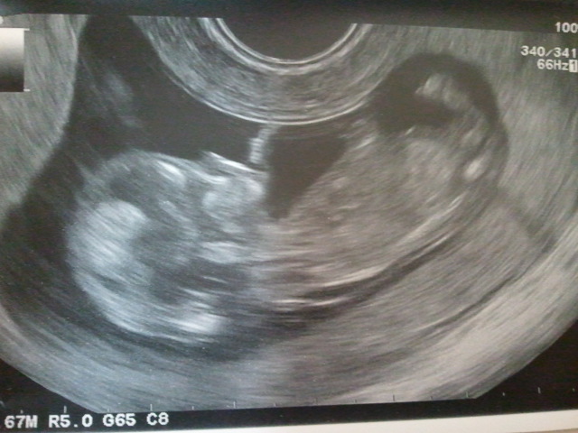 Name:  new baby 1.jpg
Views: 200
Size:  99.6 KB