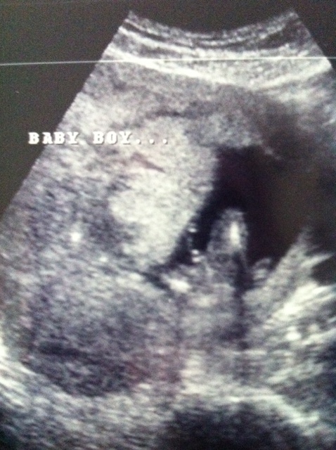 Name:  babyboy3.JPG
Views: 278
Size:  132.8 KB