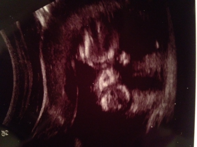 Name:  babyl 12.JPG
Views: 1842
Size:  86.6 KB