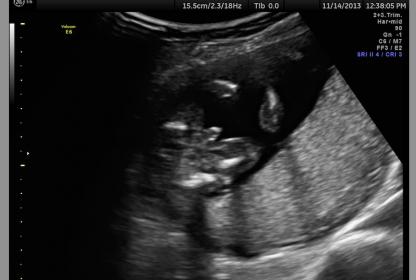 Name:  Screen Shot 2013-11-14 at 2.46.31 PM.jpg
Views: 180
Size:  15.7 KB