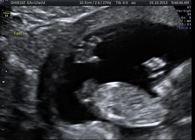 Name:  12 + 1 scan pic 3.jpg
Views: 65
Size:  103.8 KB