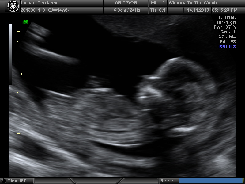 Name:  girlnub14.jpg
Views: 116
Size:  121.2 KB