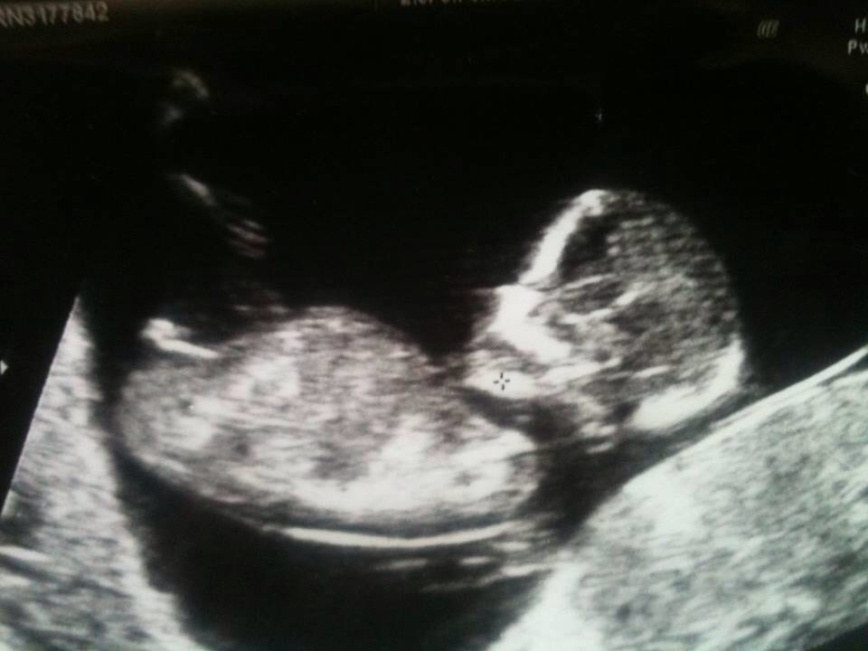 Name:  ImageUploadedByTapatalk1384792453.466259.jpg
Views: 145
Size:  212.3 KB