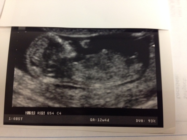 Name:  baby #2 -2.JPG
Views: 83
Size:  82.8 KB
