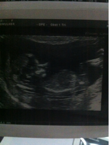 Name:  Baby Scan 12 weeks 1st.jpg
Views: 278
Size:  67.8 KB