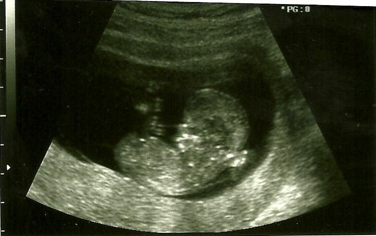 Name:  scan0003.jpg
Views: 284
Size:  42.7 KB