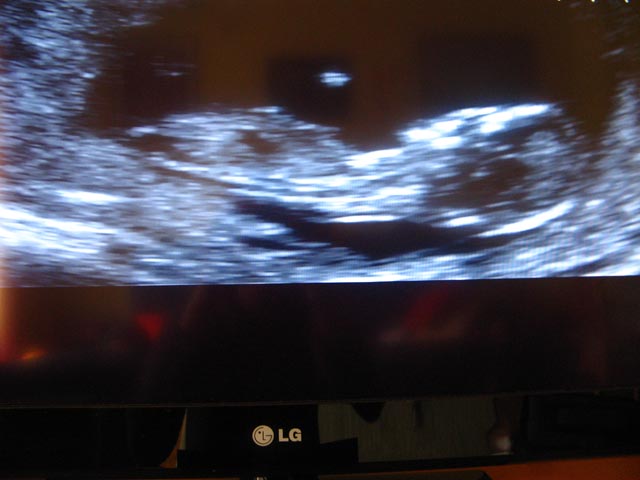 Name:  IMG_0079.JPG
Views: 301
Size:  57.4 KB