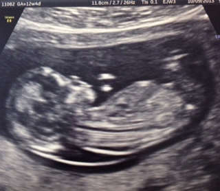 Name:  ultrasound.JPG
Views: 74
Size:  43.0 KB