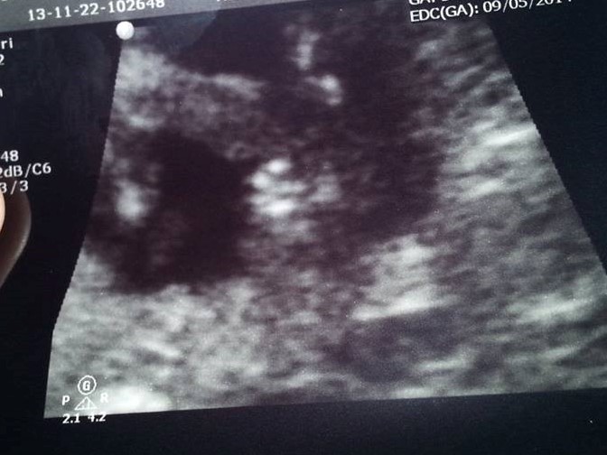 Name:  Pottyshot2 (2).jpg
Views: 1003
Size:  81.4 KB