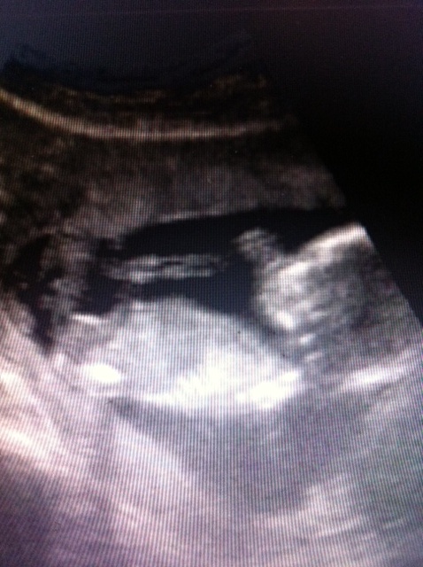 Name:  babynub2.JPG
Views: 151
Size:  114.9 KB