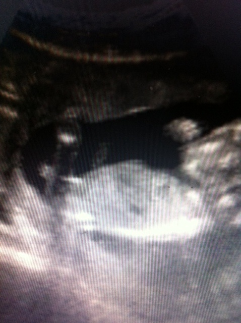 Name:  babynub.JPG
Views: 135
Size:  104.8 KB