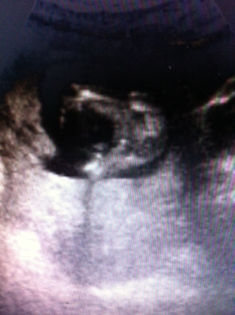 Name:  babypotty2.JPG
Views: 157
Size:  118.4 KB