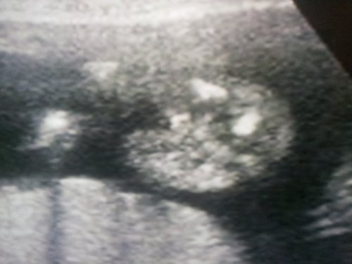 Name:  cDC6eH1ZwtjqyquDyfk9t4GCsJocsXbz_lg.jpg
Views: 171
Size:  23.1 KB