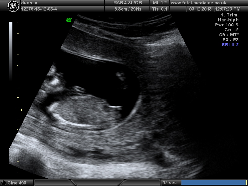 Name:  BABY_22.JPG
Views: 95
Size:  146.5 KB