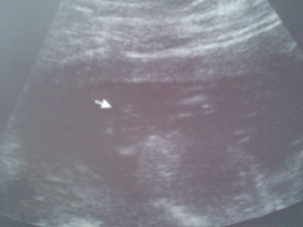 Name:  BabyG15.6.jpg
Views: 191
Size:  28.5 KB