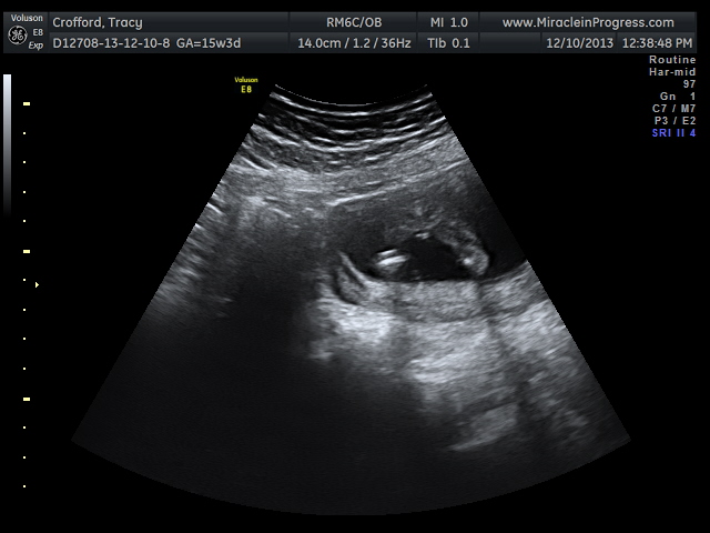 Name:  baby girl_3.jpg
Views: 344
Size:  89.4 KB