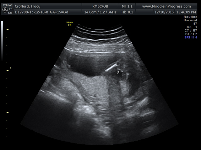 Name:  baby girl_12.jpg
Views: 357
Size:  92.5 KB