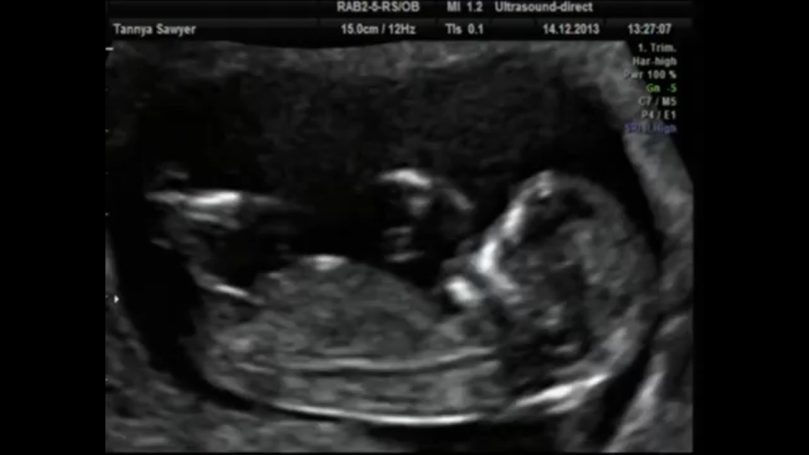 Name:  scan12+2.jpg
Views: 148
Size:  81.7 KB
