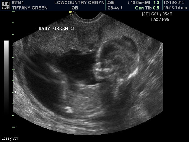 Name:  TIFFANY 14 WKS_1.JPG
Views: 33305
Size:  125.6 KB