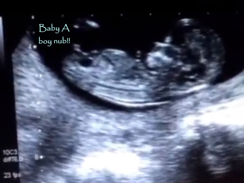 Name:  babya.jpg
Views: 120
Size:  46.8 KB