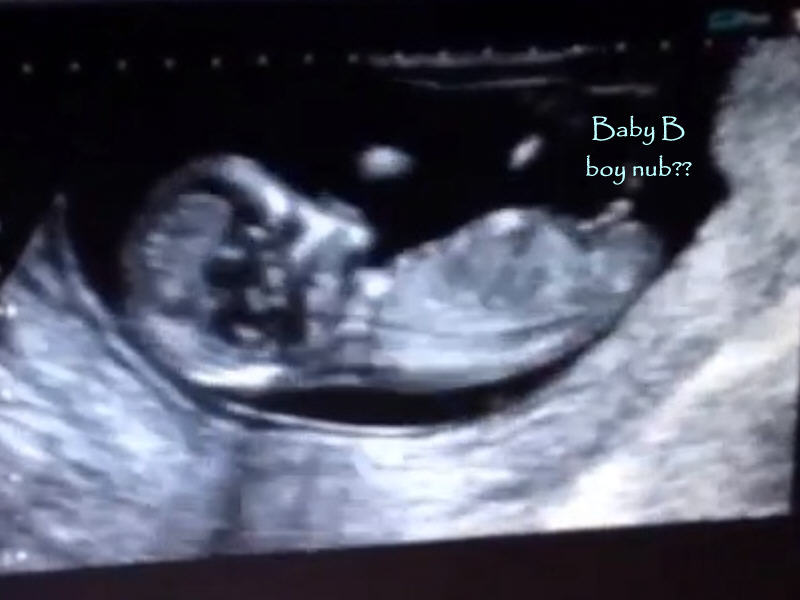 Name:  babyb.jpg
Views: 131
Size:  43.1 KB