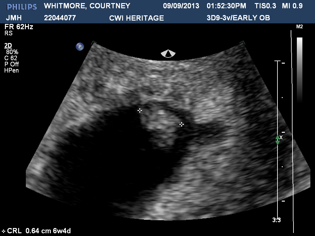 Name:  6 week.jpg
Views: 108
Size:  168.6 KB