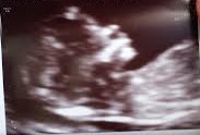 Name:  babyy2.jpg
Views: 181
Size:  12.8 KB