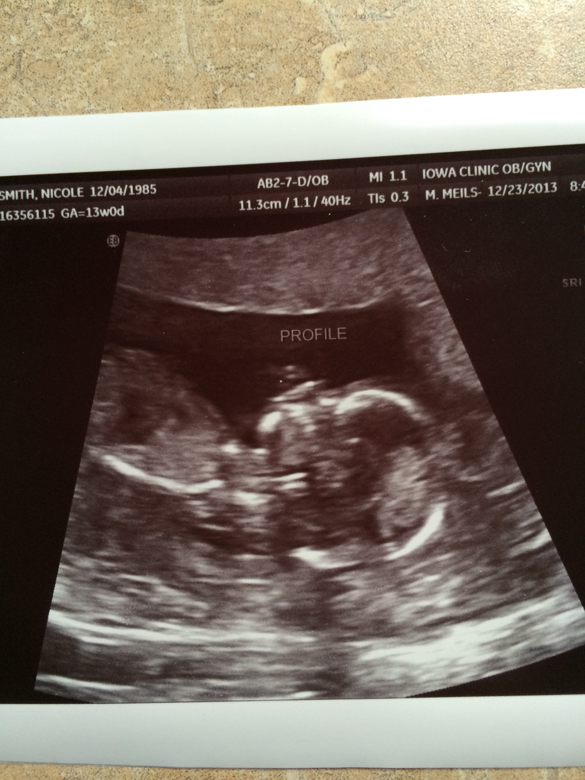 Name:  13Weeks.JPG
Views: 982
Size:  1.71 MB