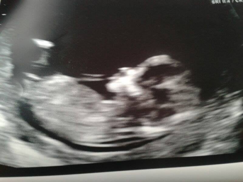 Name:  baby2.jpg
Views: 180
Size:  37.5 KB