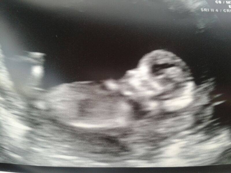 Name:  baby.jpg
Views: 149
Size:  42.4 KB