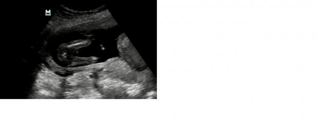 Name:  Nr2.jpg
Views: 757
Size:  10.0 KB